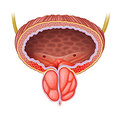 Zvětšená prostata